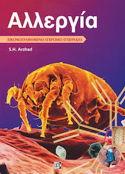 Αλλεργία