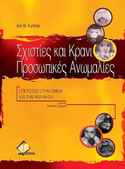 Σχιστίες και κρανιοπροσωπικές ανωμαλίες
