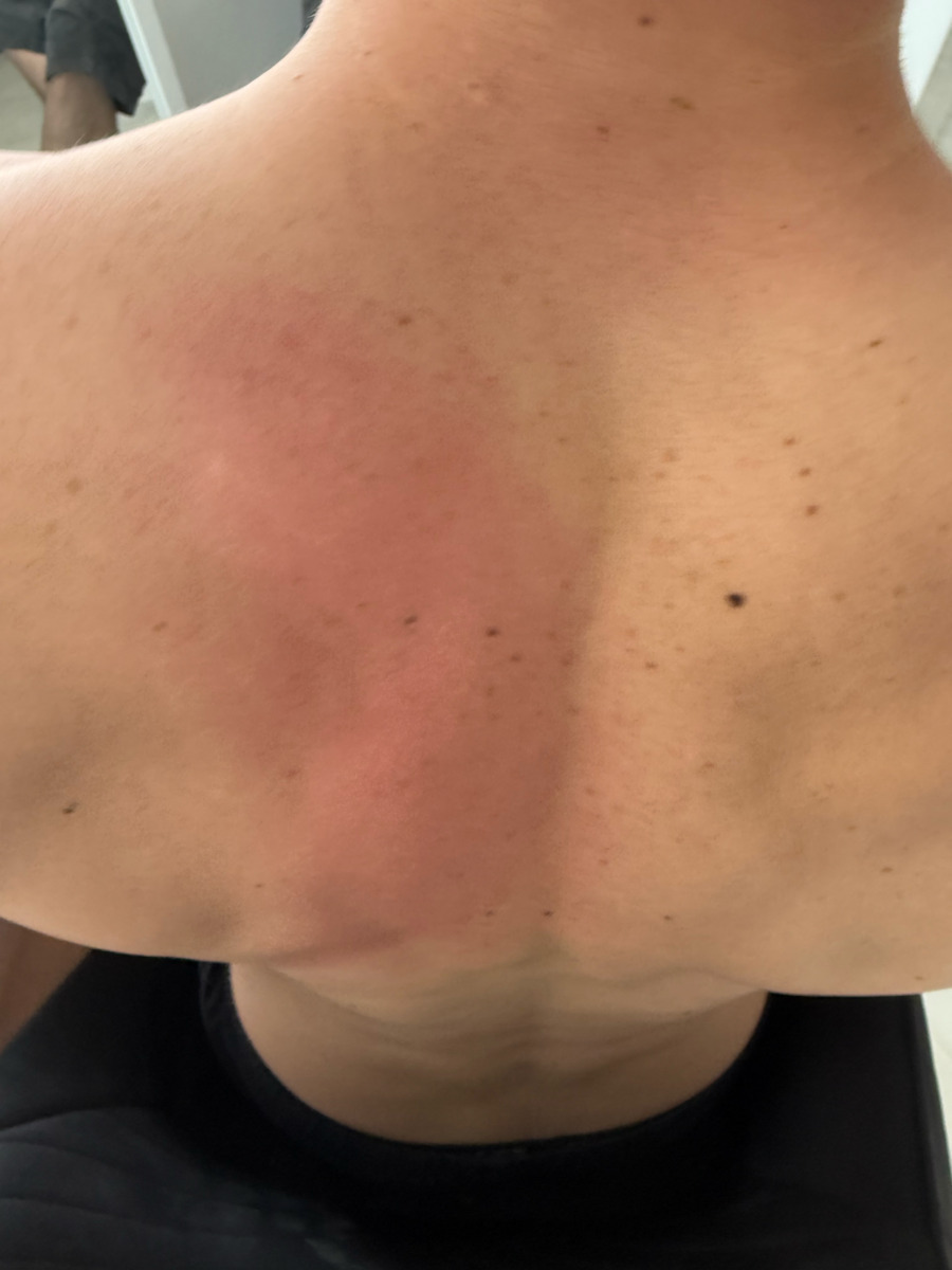 ACP Gun Massage for the Legs, the Body & the Hands with Vibration