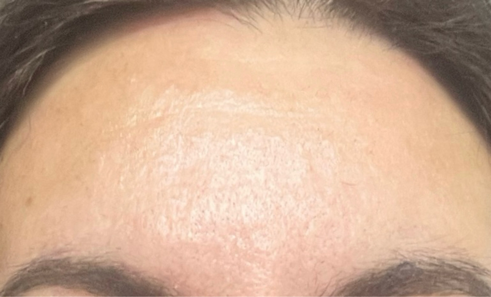 La Roche Posay Cicaplast Baume B5+ Αναπλαστικό Balm για Πρόσωπο & Χείλη με Πανθενόλη & Centella Asiatica 40ml