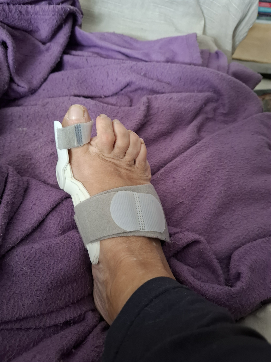 Tynor Bunion Splint OIK/Hallufix