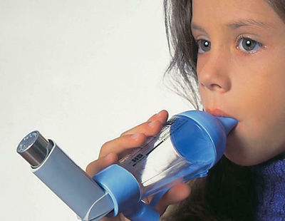 Able Asthma Spacer Αεροθάλαμος Εισπνοών Universal με Επιστόμιο