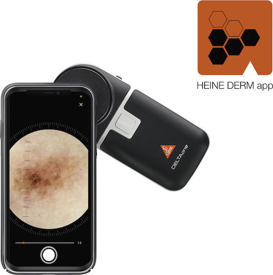 Heine Delta One Dermatoscope