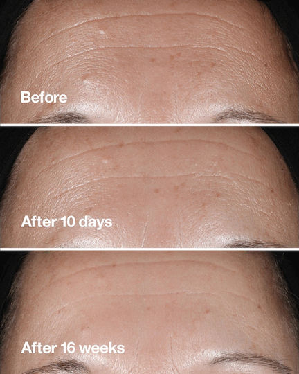 Clinique Smart Clinical Repair Moisturizing & Anti-aging Serum Face with Hyaluronic Acid for Radiance & Firming 30ml