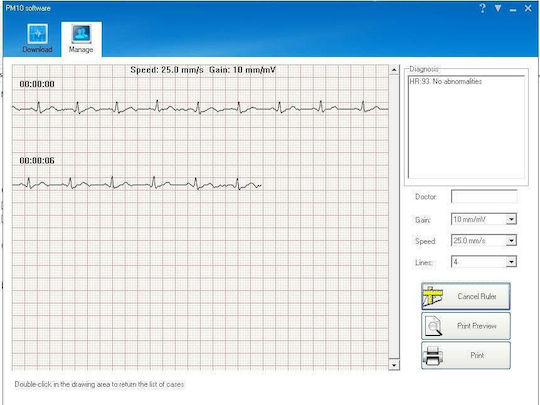 Contec Palm Ecg PM10 Cardiographer 1-Channel