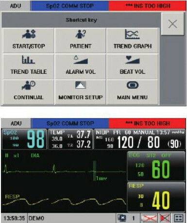 Comen C30 Monitor Ιατρικών Μηχανημάτων