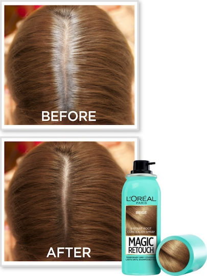 L'Oreal Paris Magic Retouch Προσωρινή Βαφή Μαλλιών σε Spray Dark Blonde 75ml