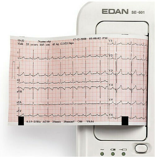 Edan SE-601B Καρδιογράφος 6-Κάναλος