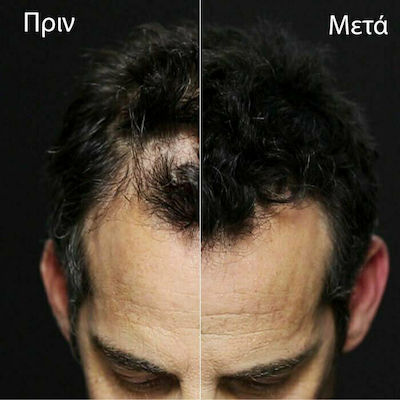 Toppik Ίνες Κάλυψης Αραίωσης Μαλλιών με Κερατίνη Hair Building Fibers Economy Light Brown 27.5gr