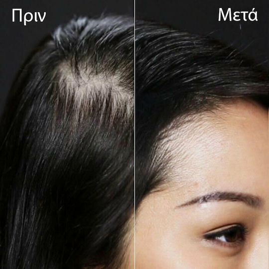Toppik Hair Building Fibers with Keratin Hair Building Fibers Regular Auburn 12gr