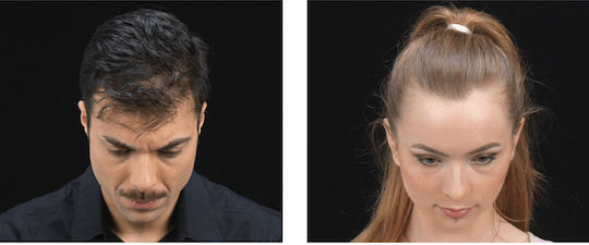 Kmax Milano Hair Thinning Coverage Fibers with Keratin Hair Fibers Regular 15g