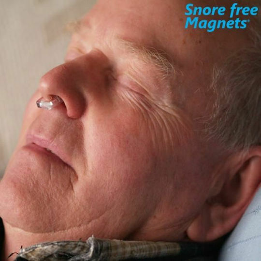 Snore Free Magnets Ρινικός Διαστολέας για το Ροχαλητό Διάφανος 1τμχ