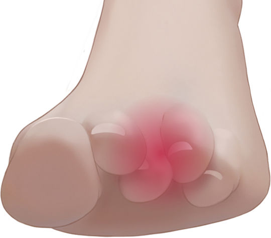 Vita Orthopaedics mit Gel Mittel