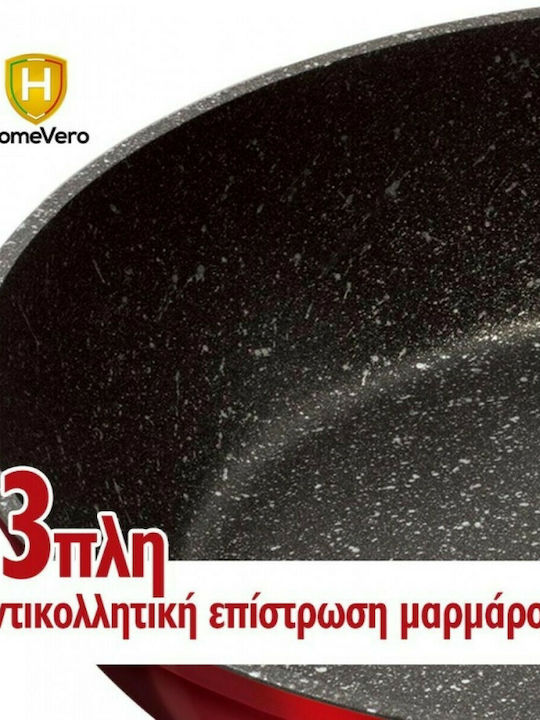 HomeVero Сет Тигани от Алуминий Черни с Вътрешно Покритие от Камък 3 Части