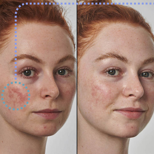 The Inkey List Super Solutions 10% Azelaic Acid Serum Face 30ml