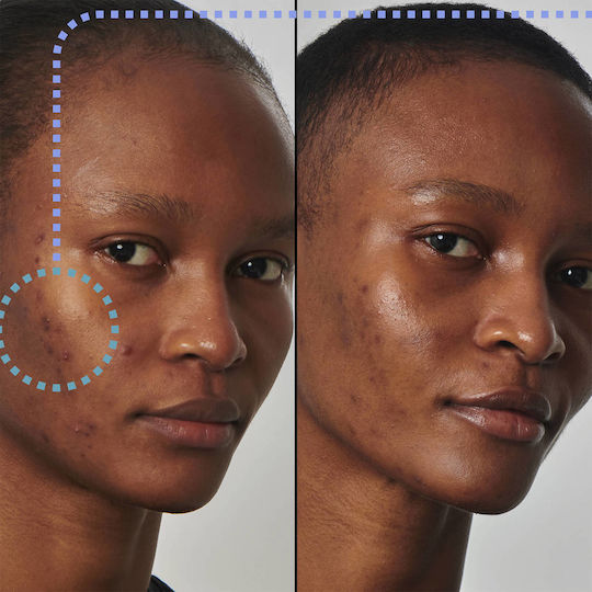The Inkey List Super Solutions 20% Ncinamide Serum Face with Niacinamide for Firming 30ml