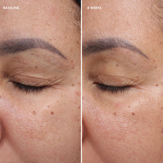 Colorescience Total Eye Firm & Repair Κρέμα Ματιών για Αντιγήρανση , Ενυδάτωση & Μαύροι Κύκλοι 18ml