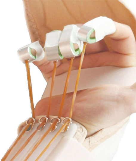 Aurafix Thermoplastic Pheocarpopodactyl Splint Right Side Beige