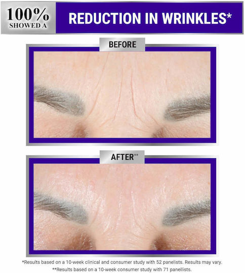 Kiehl's Retinol Skin-Renewing Anti-aging Serum Face with Retinol & Peptides 30ml