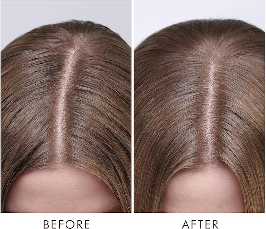 Moroccanoil Dry Scalp Treatment Serum For Repair 45ml