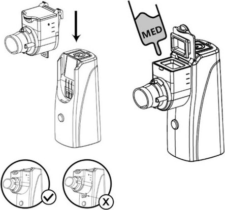 Wellion Mesh Inhalator Φορητός Νεφελοποιητής