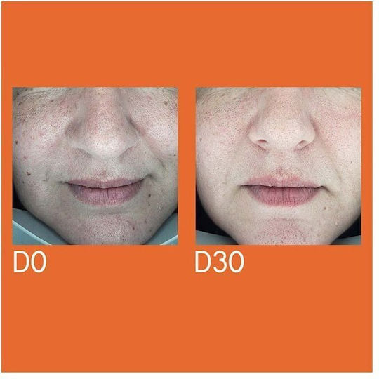 Youth Lab. Dark Spot Remover Serum Gesicht mit Vitamin C & Peptide für Flecken 30ml