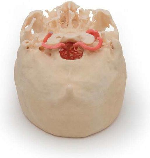 Erler Zimmer Skull/Head Model