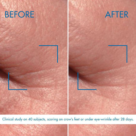 Biotherm Blue Pro-Retinol Eye Cream for Dark Circles 15ml