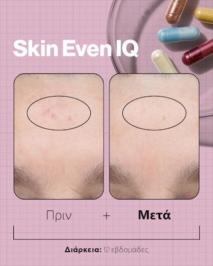 Advanced Nutrition Programme Skin Even Iq Ειδικό Συμπλήρωμα Διατροφής 140 κάψουλες