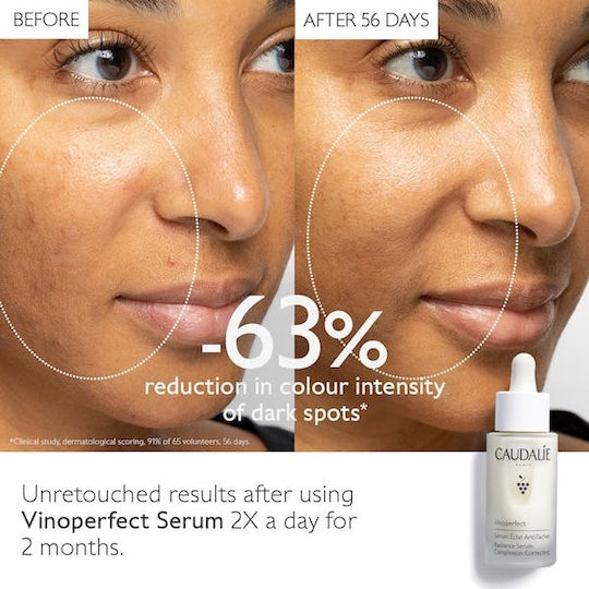Caudalie Vinoperfect Radiance Complexion Correcting Anti-Aging Serum Gesicht 30ml