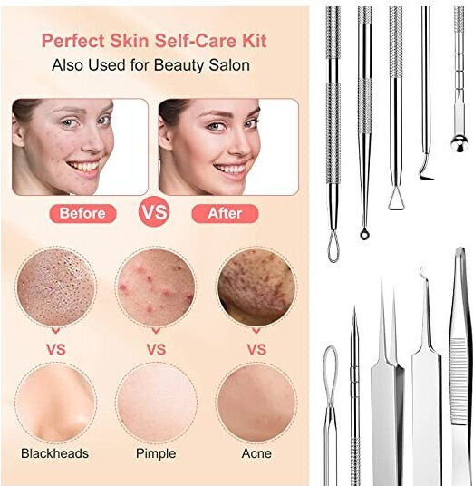 Bestope Blackhead Tools 10pcs