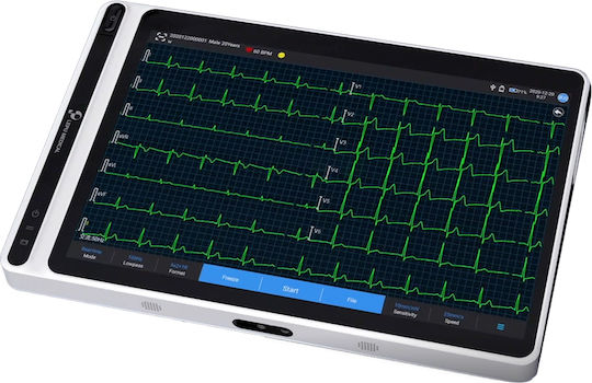 Gima Neo Ecg S120 Кардиограф
