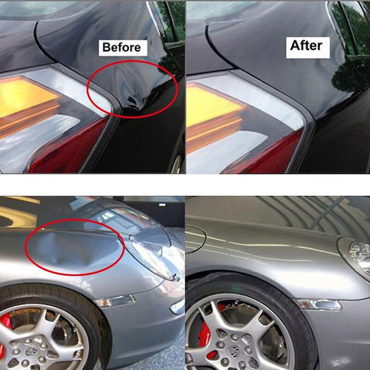for Car Dents