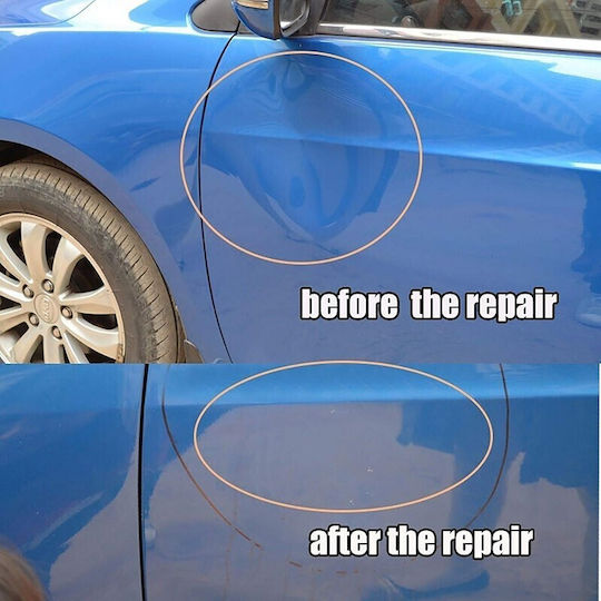 for Car Dents