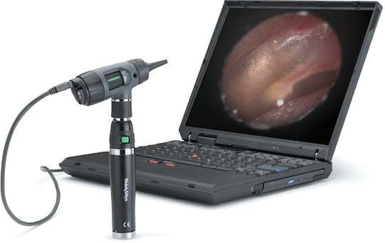 Κεφαλή Ωτοσκοπίου Digital Macroview Welch Allyn