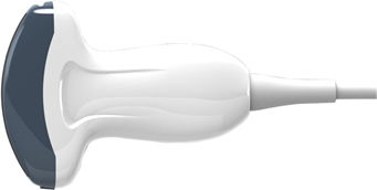 Chison Convex C3-a Γυναικολογικό Doppler