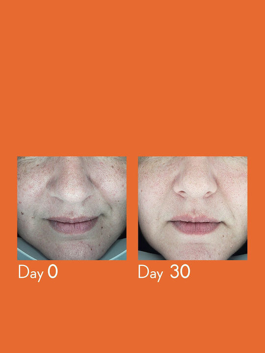 Youth Lab Promo Dark Spot Remover Serum 30ml & Brightening Vit-c Gel Cream 20ml & Brightening Vit-c Hydra-gel Eye Patches 1 Pc