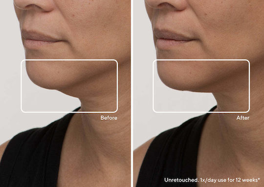 Therabody Theraface Αnti-ageing Light Therapy Face Mask LED & Infrared