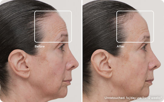 Therabody Theraface Αnti-ageing Light Therapy Face Mask LED & Infrared