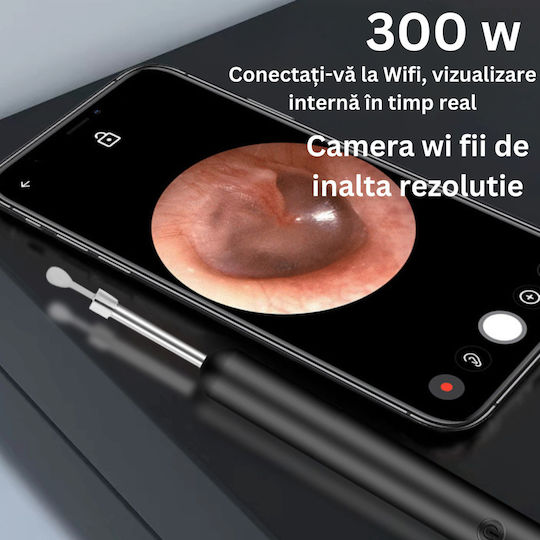 Smart Endoskop Ohr Reinigung 5mp Full Hd Kamera Led Licht Wi-fi Zubehör enthalten Ladekit 350 Mah wasserdicht Ip67 Batterie grün