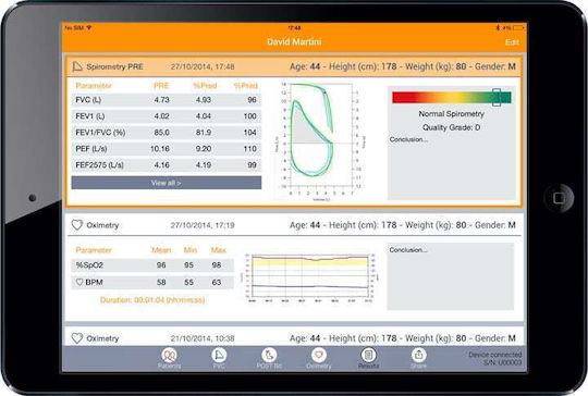 MIR Spirometru Spirobank Ii Smart