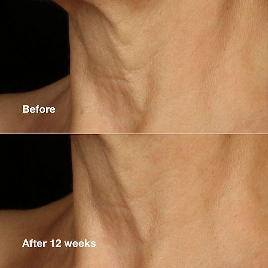 Clinique Smart Clinical Repair Rich Κρέμα Προσώπου για Ενυδάτωση, Αντιγήρανση & Σύσφιξη με Υαλουρονικό Οξύ & Πεπτίδια 75ml