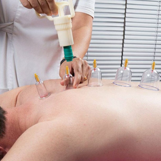 Therapeutic Device with Suction Cups Set 24pcs