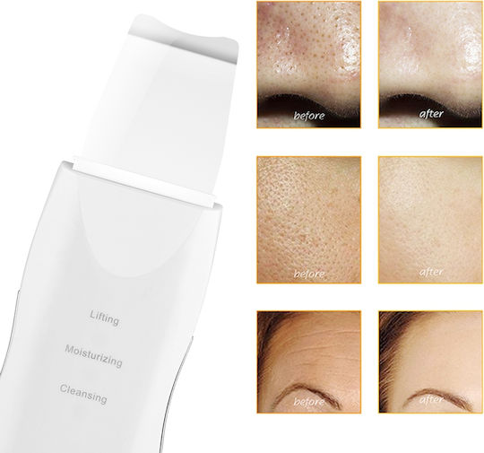 Skin Scrubber Προσώπου ZE1AG23QWS07F