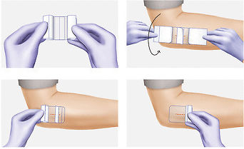 Hartmann Hydrofilm Plus Waterproof & Sterilized Plasters 20x10cm 25pcs