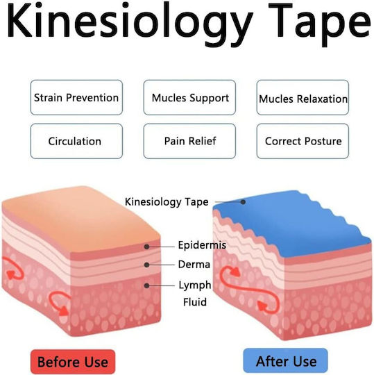 Kinesiological Tape Ubx 5 M Cream