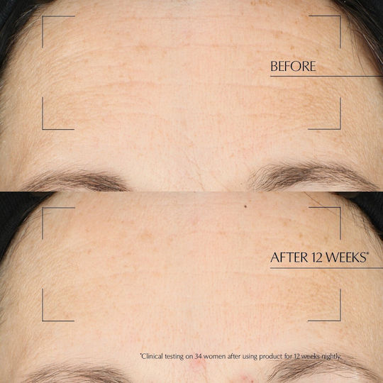 Advanced Night Repair Overnight Treatment 65ml Skin Type All Types