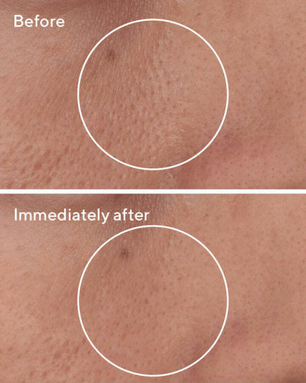 Murad Targeted Cream Face 15ml