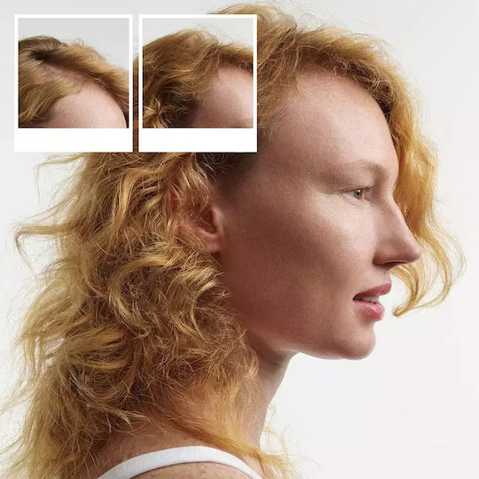 Nioxin 4 Комплекта Грижа За Косата За Лечение На Косопад За Боядисана Коса С Шампоан И Балсам 3 Бройки