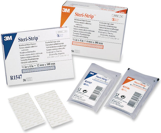 3M Surgical Sutures Length 10cm Steri Strip